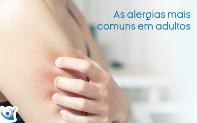 As alergias mais comuns em adultos