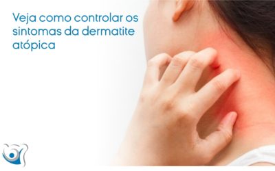 Veja como controlar os sintomas da dermatite atópica