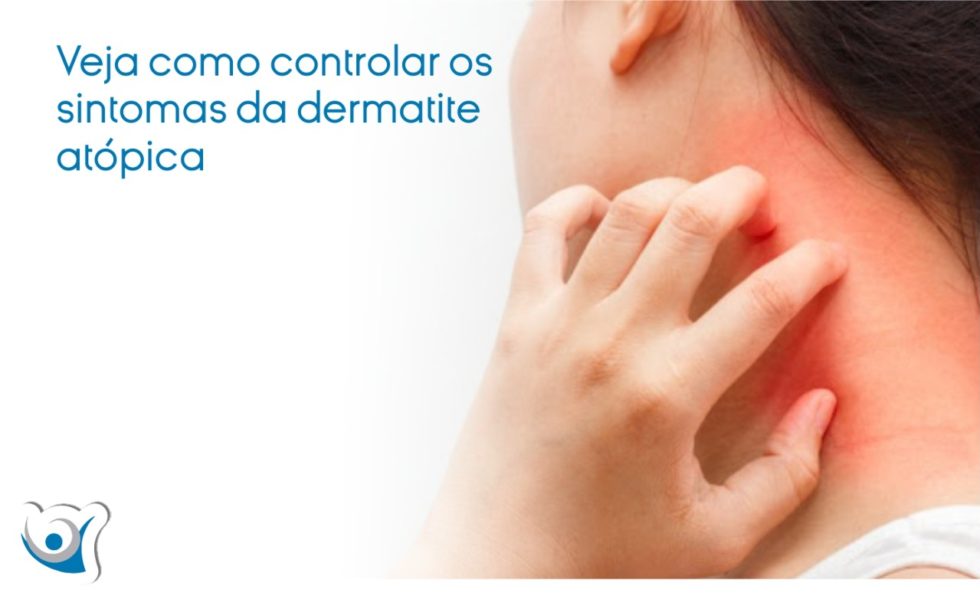 Veja Como Controlar Os Sintomas Da Dermatite Atópica Alergoclínica 0179