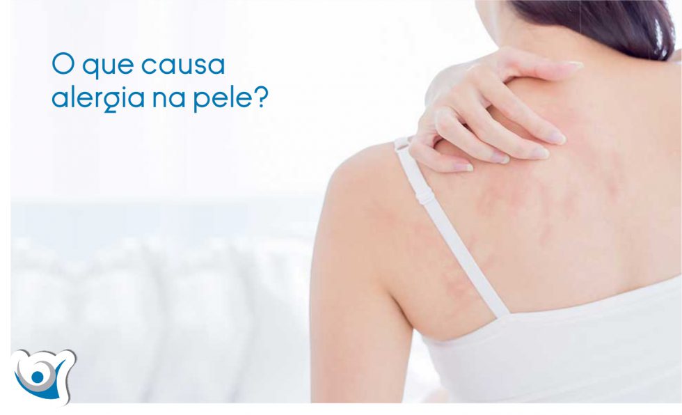 O que causa alergia na pele Alergoclínica