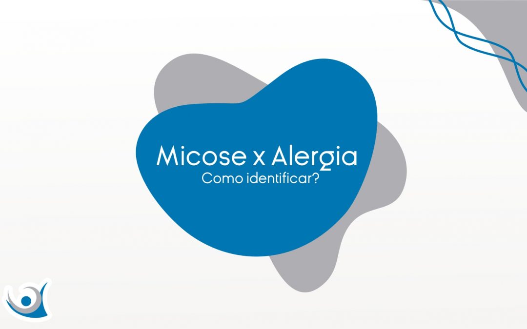 Diferença micose e alergia Alergoclínica