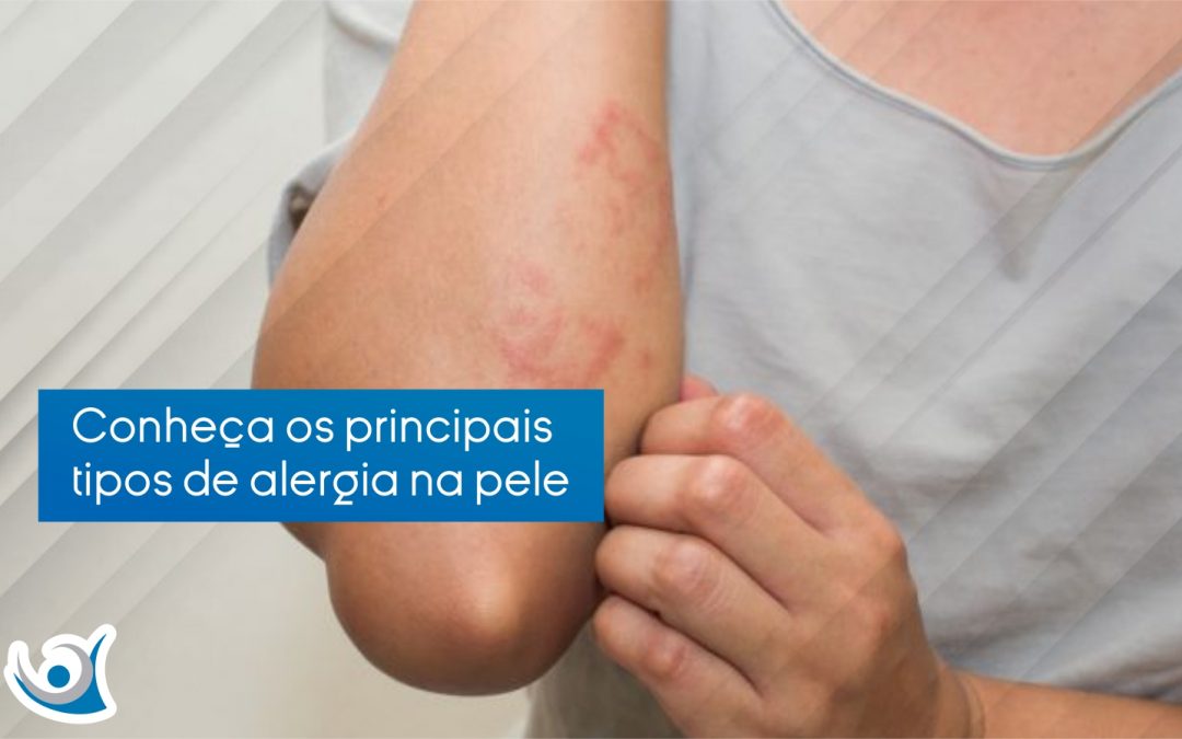 pessoa coça alergia na pele e o texto: tipos de alergia na pele