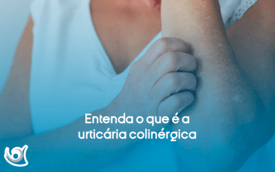 Urticária colinérgica: causas, sintomas e tratamento