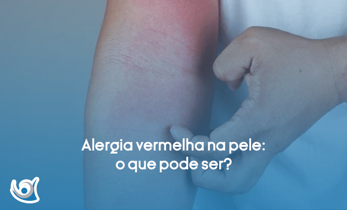 Alergia vermelha na pele: o que pode ser?