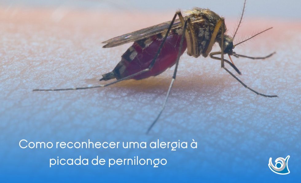 Como reconhecer uma alergia à picada de pernilongo - Alergoclínica