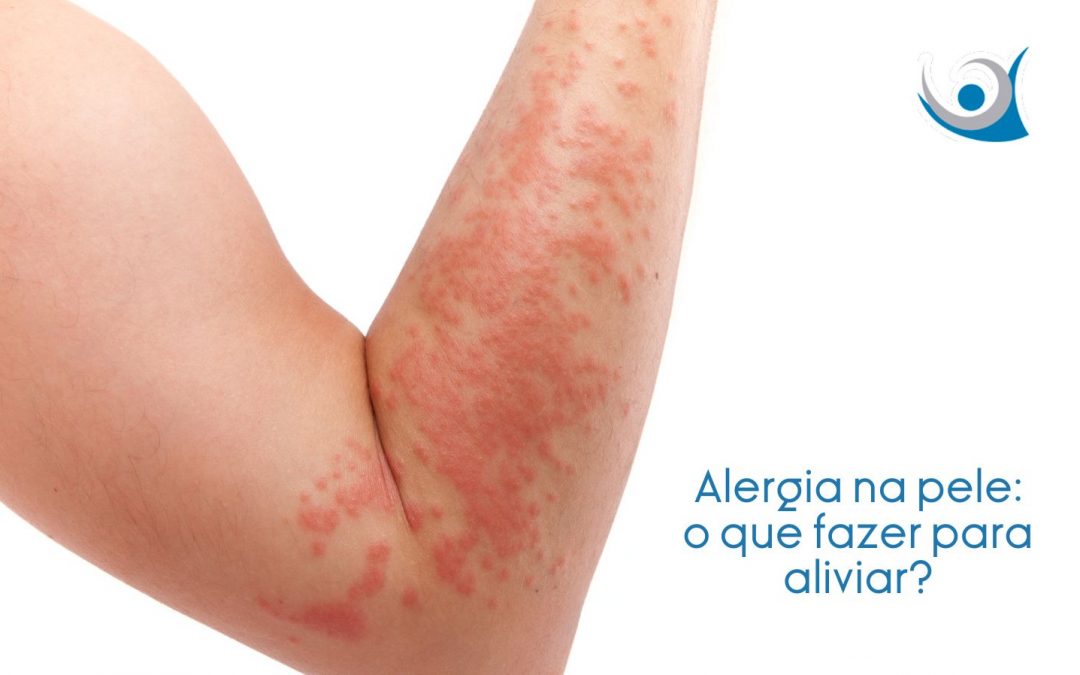 alergia na pele o que fazer Alergoclínica