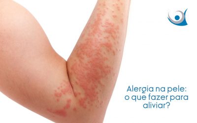 Alergia na pele: o que fazer para aliviar?