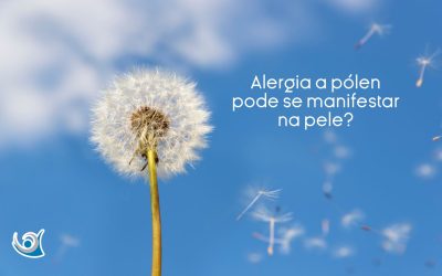 Alergia ao pólen pode se manifestar na pele?