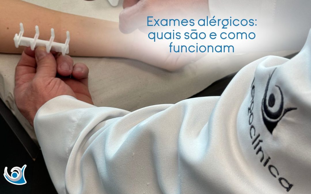 exames alérgicos Alergoclínica