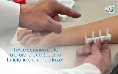 Teste cutâneo para alergia: o que é, como funciona e quando fazer