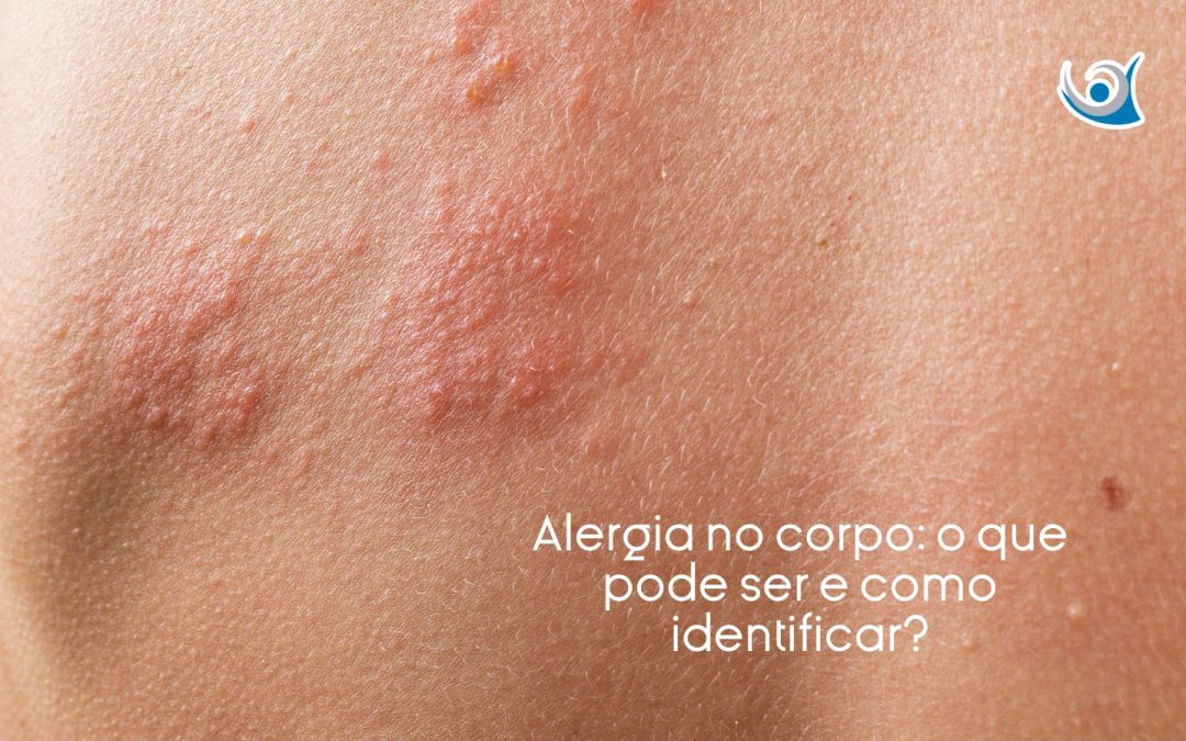 alergia no corpo o que pode ser