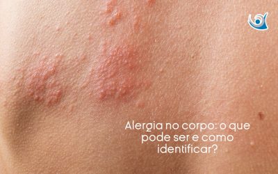 Alergia no corpo: o que pode ser e como identificar?